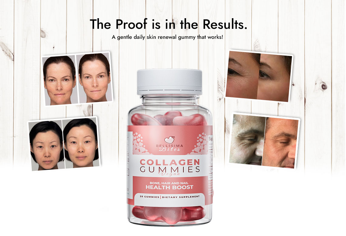 Bellisima-Bites-Collagen-Gummies